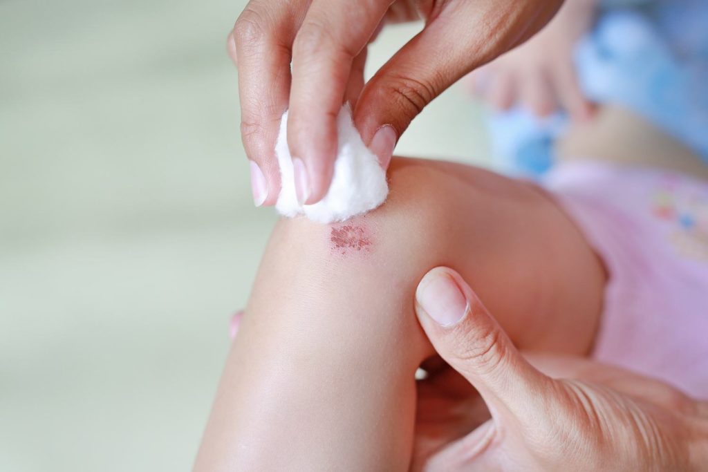 Collagen helps kids strengthen skin and aids in wound healing